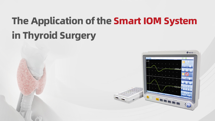 Vídeo de funcionamiento del Smart IOM